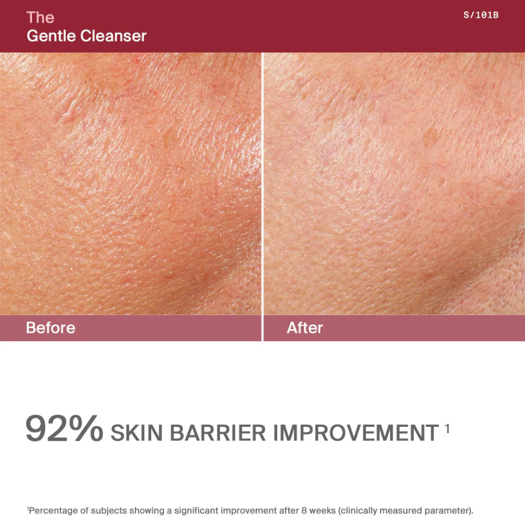 The Gentle Cleanser - Image 5